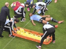 Uruguay player stays in game after head injury